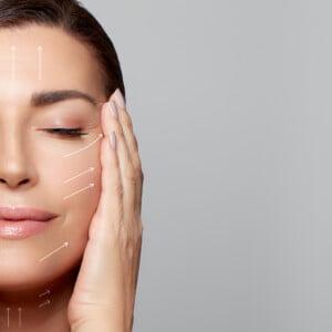 Dermal Filler - Lines and Wrinkles