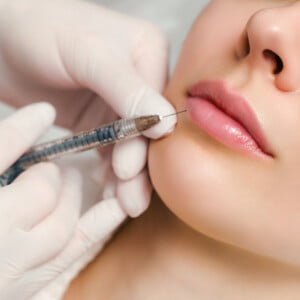 Lip Fillers